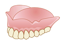 総入れ歯（総義歯）